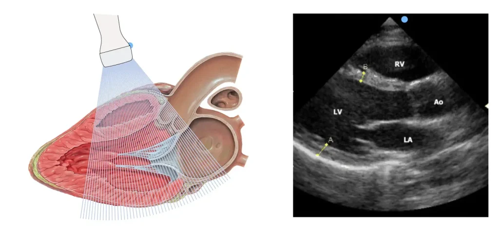 اکو قلب در اصفهان